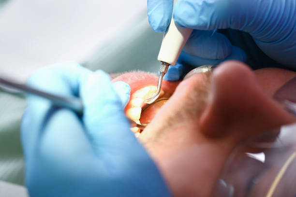 Best Emergency Dentist for Knocked-Out Tooth in Longbranch, WA