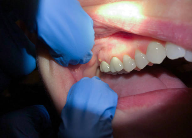 Best Mobile Emergency Dentist in Longbranch, WA