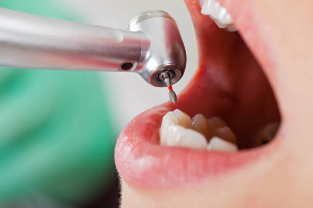 Best Holiday Emergency Dentist in Longbranch, WA